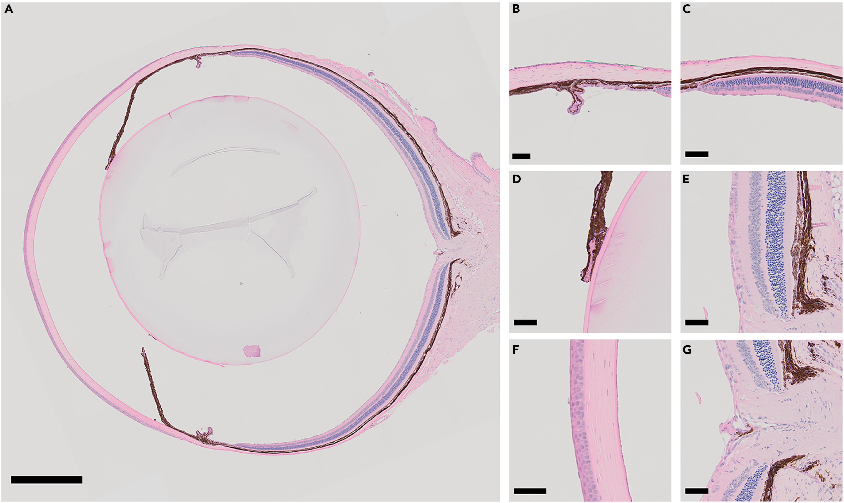 Step-by-step preparation of mouse eye sections for routine histology,  immunofluorescence, and RNA in situ hybridization multiplexing