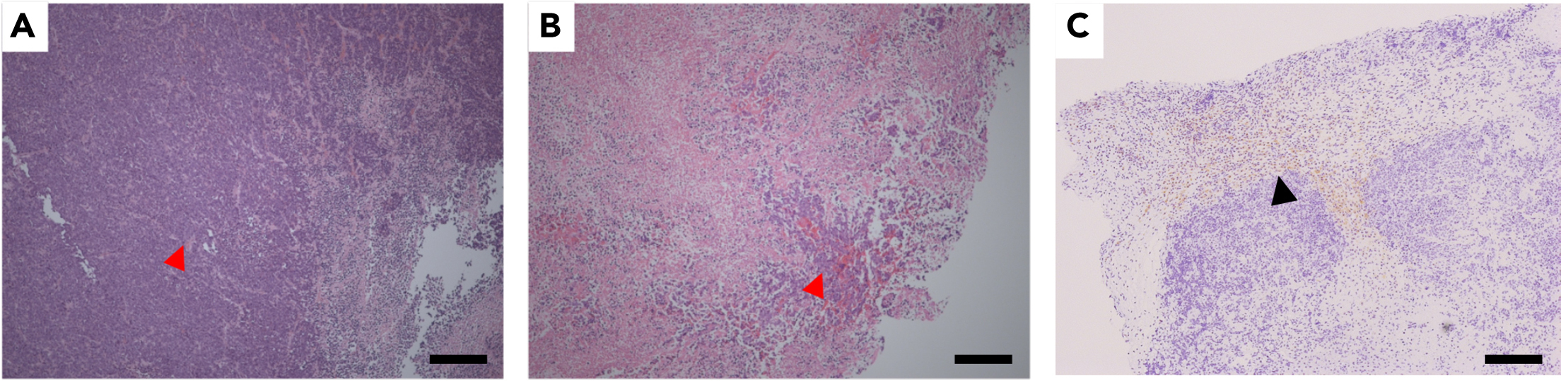 Preclinical testing of chimeric antigen receptor T cells in 