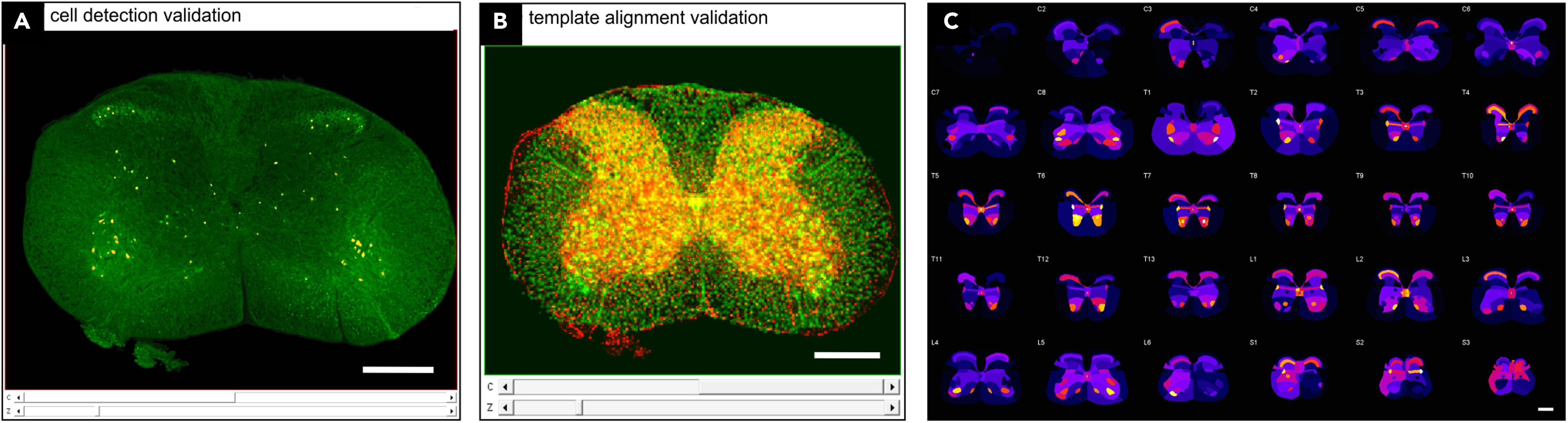 Tools for efficient analysis of neurons in a 3D reference atlas of whole  mouse spinal cord - ScienceDirect