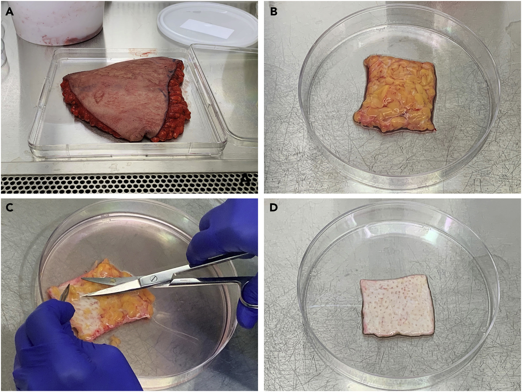 Human skin reconstitution in the cell-sorted skin equivalent (CeSSE)