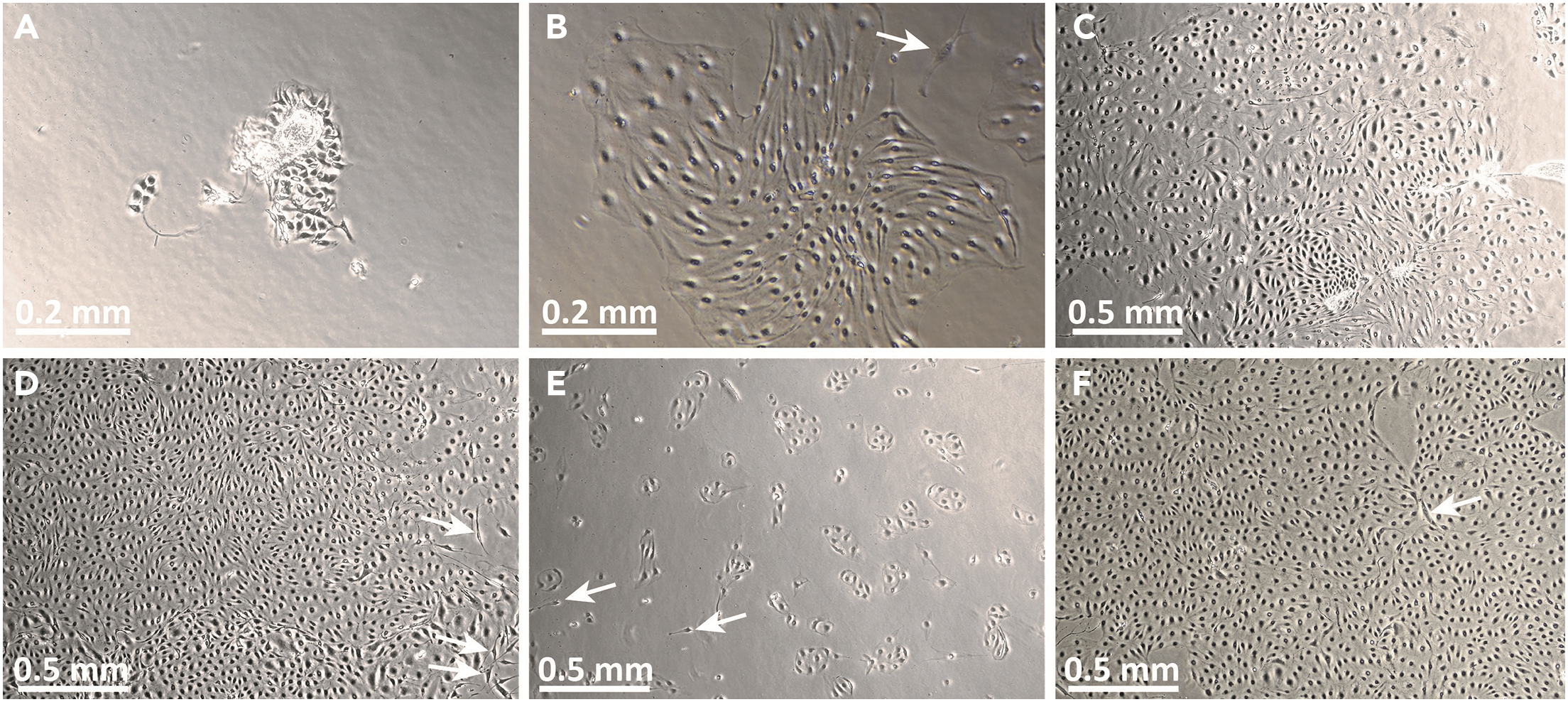 Human skin reconstitution in the cell-sorted skin equivalent (CeSSE)