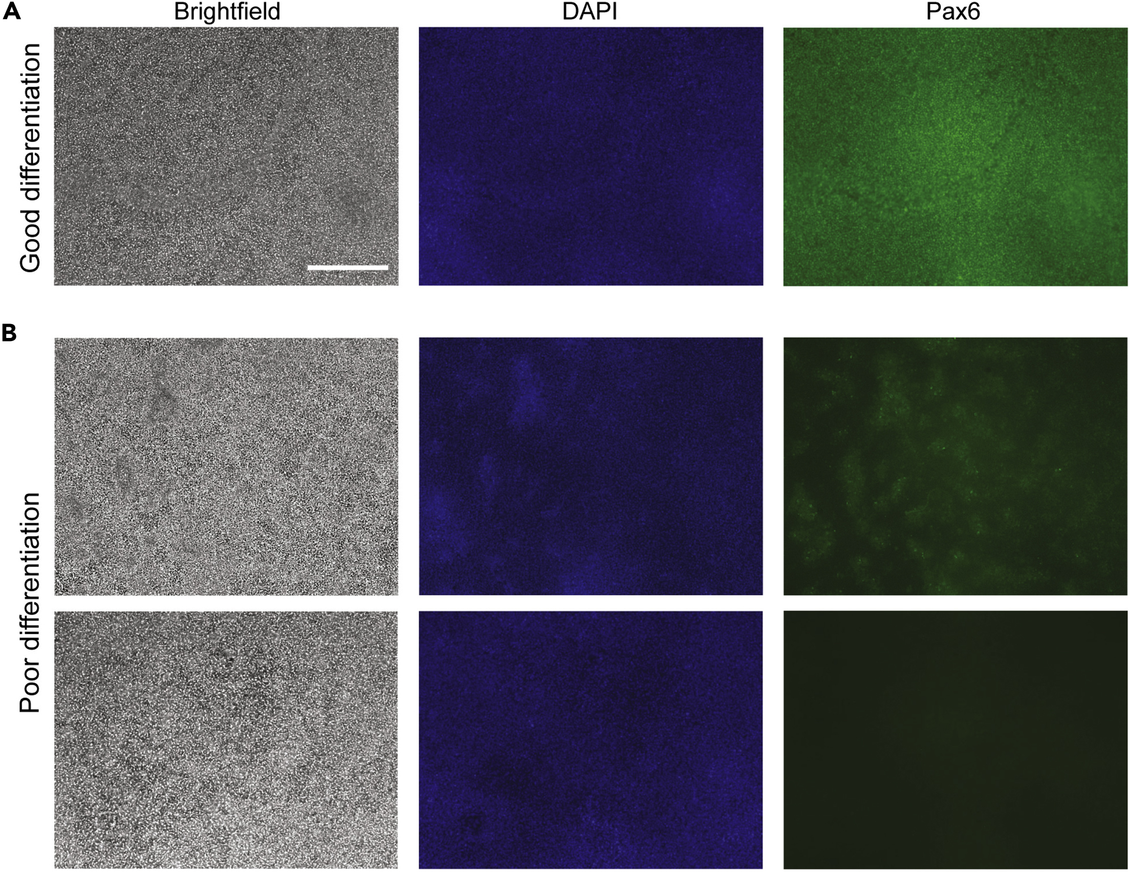 ピリオド4枚 ピリオド4枚 Amazon.co.jp: KN Planning Dio ZX Gyro Canopy