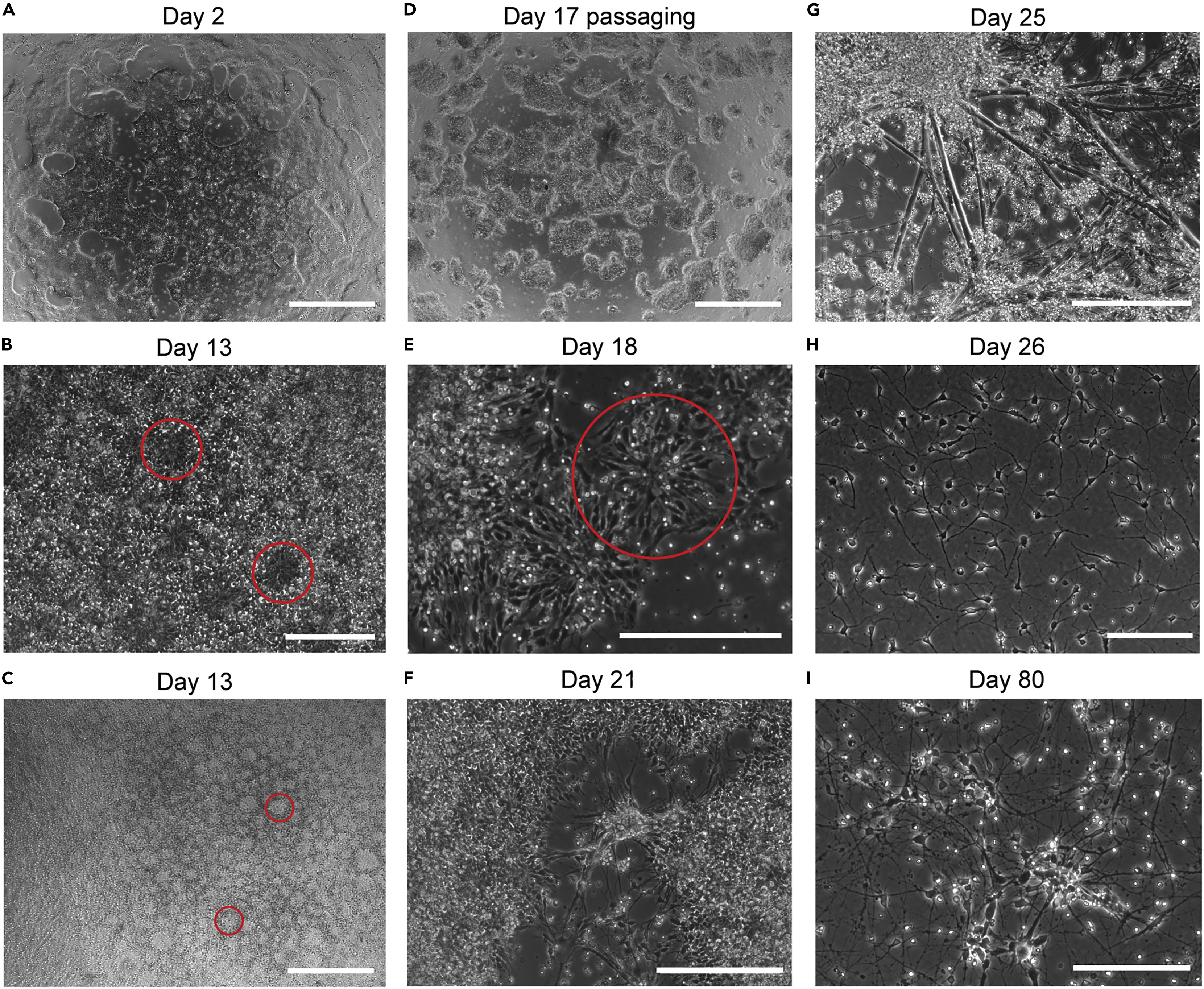 Generation of a CHIP isogenic human iPSC-derived cortical neuron