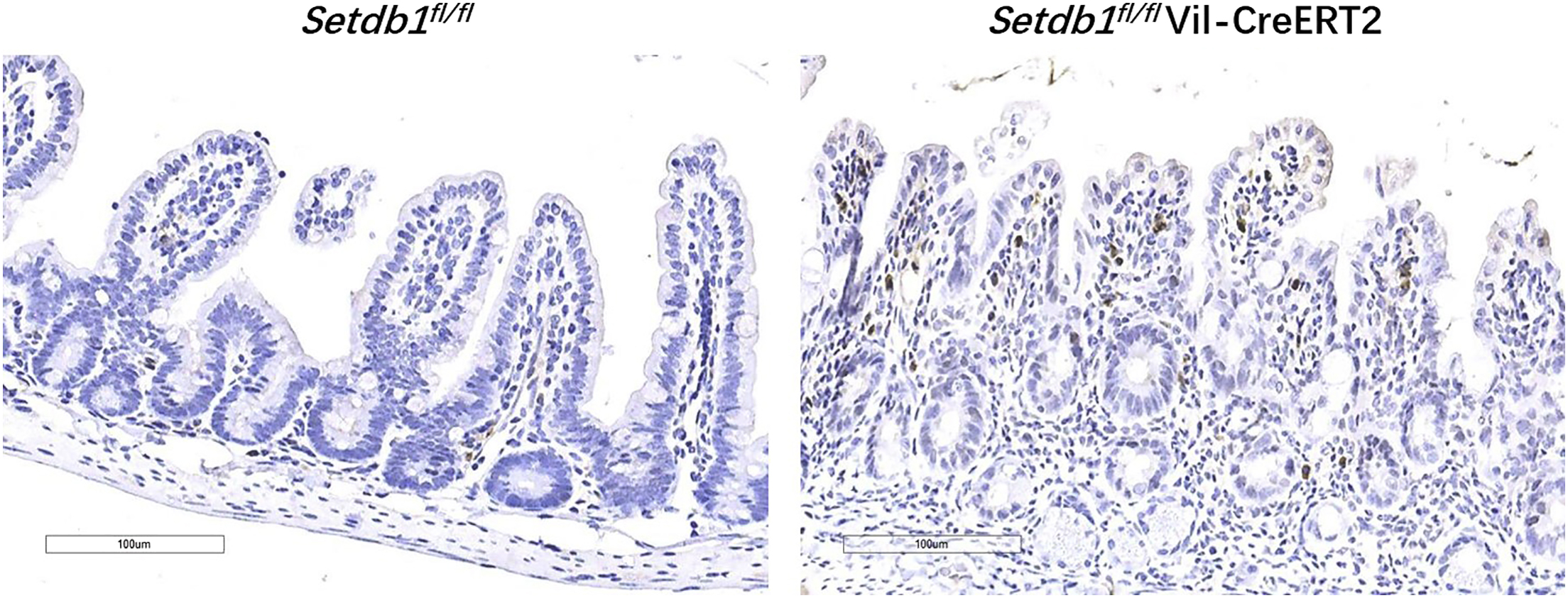 Immunostaining of phospho-RIPK3 in L929 cells, murine yolk sacs
