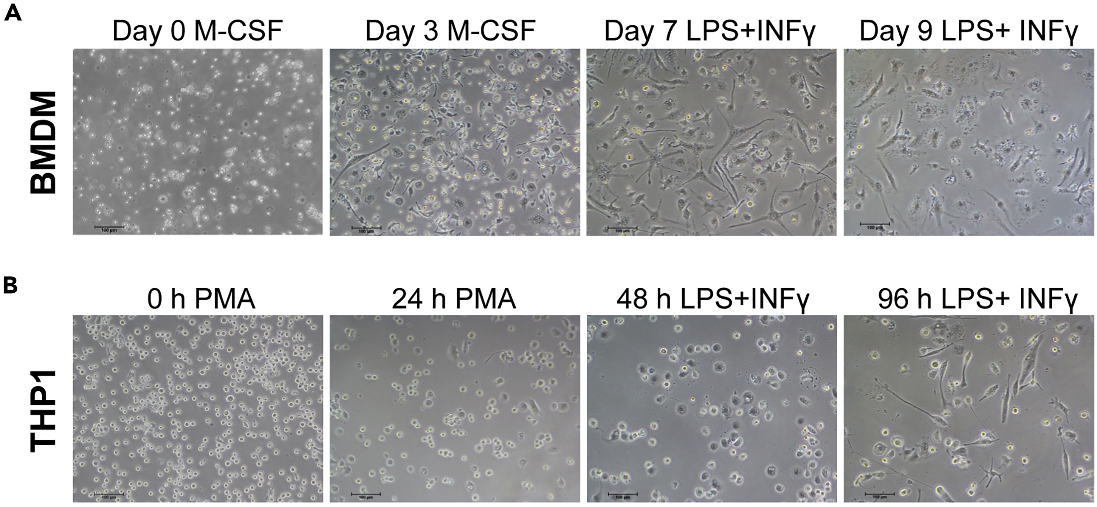 Protocol for detecting macrophage-mediated cancer cell