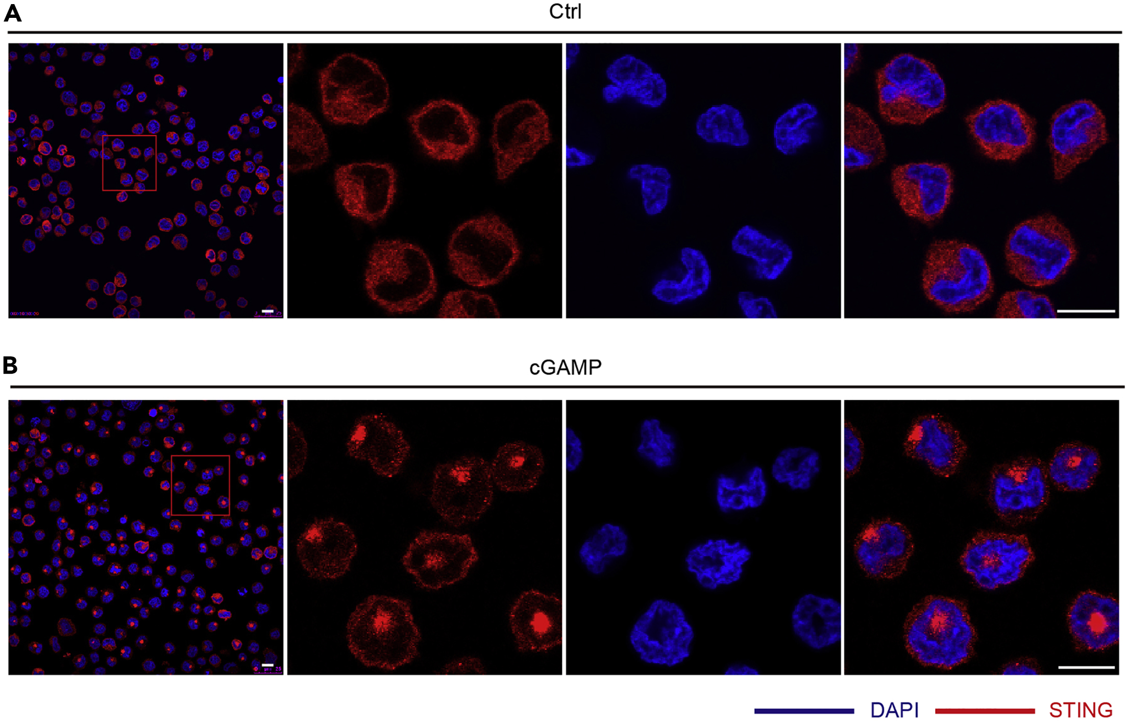 Protocol using lentivirus to establish THP-1 suspension cell lines