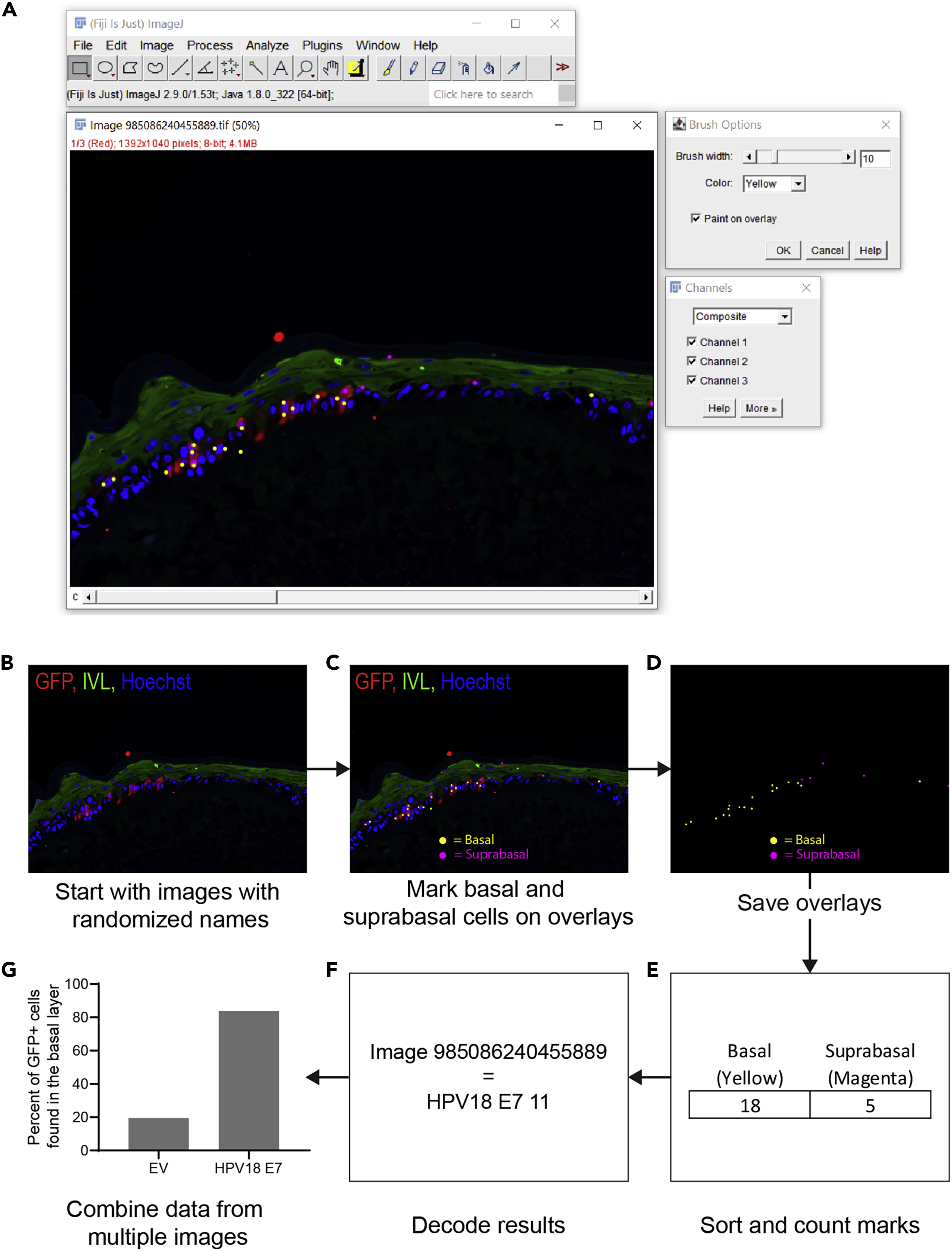 Unveiling The Star Epithelial Cell: Which Type Reigns Supreme? - nd3fbp9