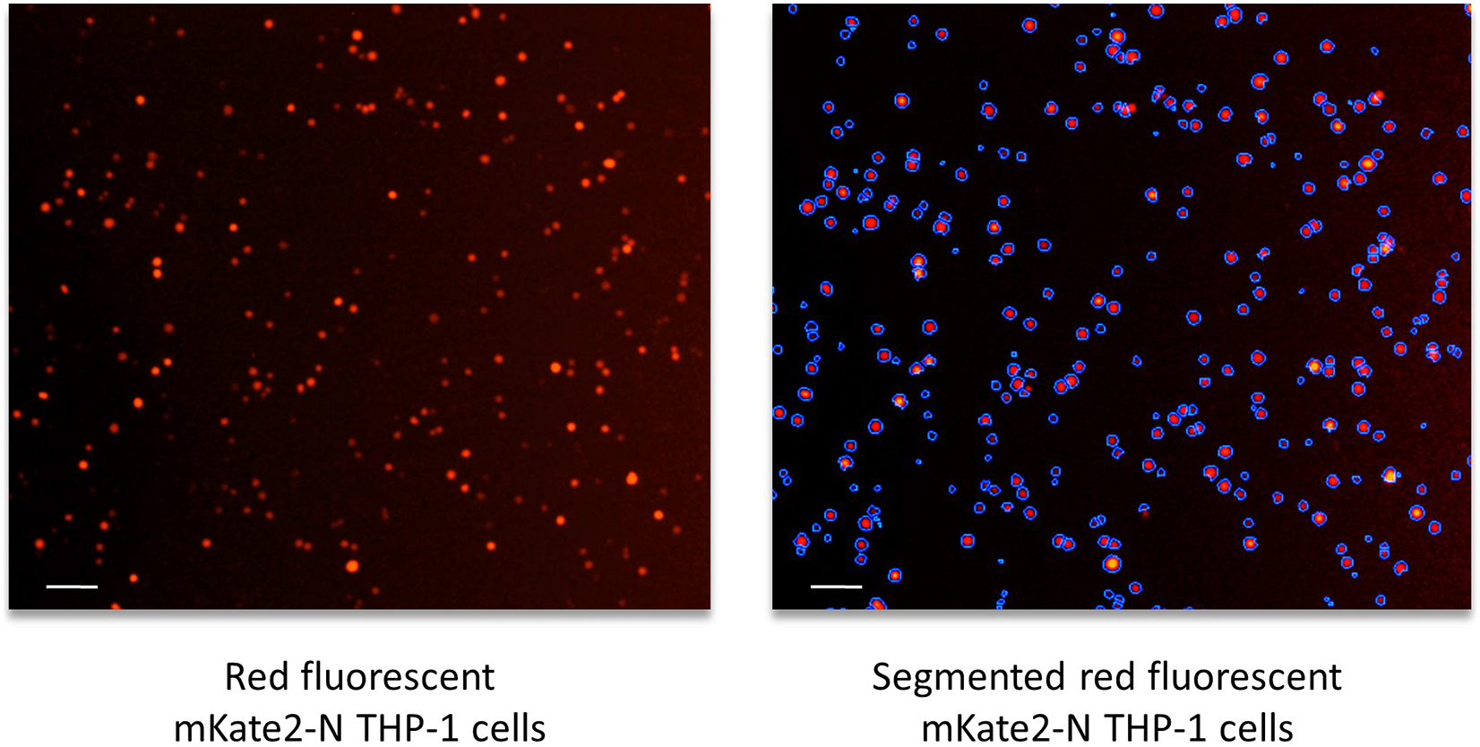 Protocol for in vitro assessment of human monocyte