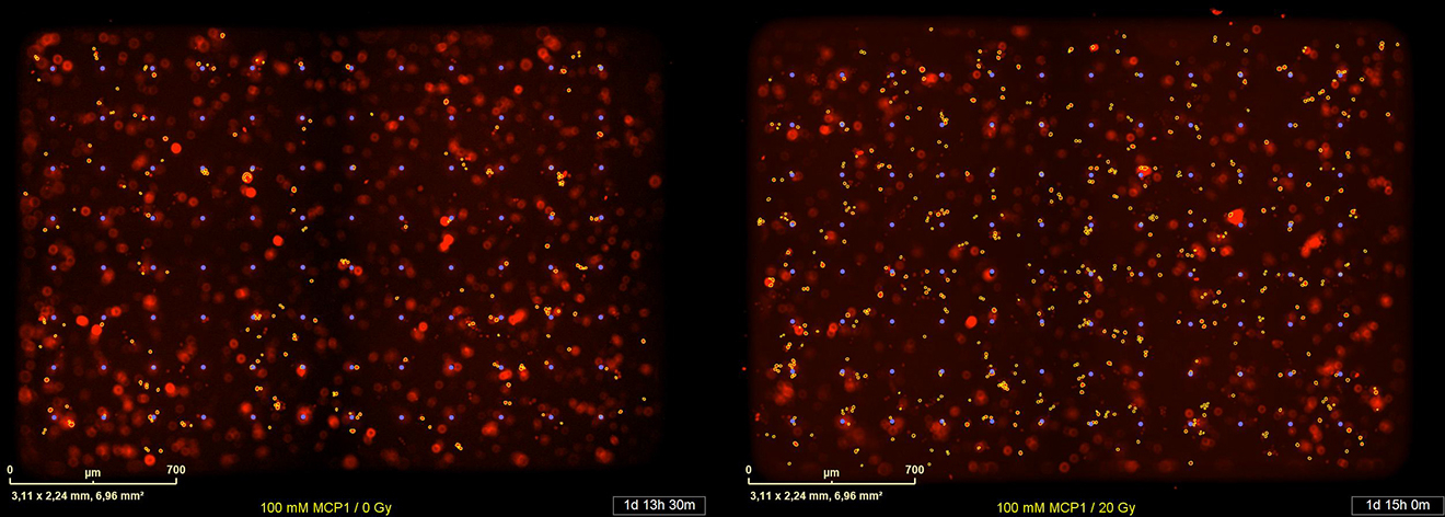 Protocol for in vitro assessment of human monocyte