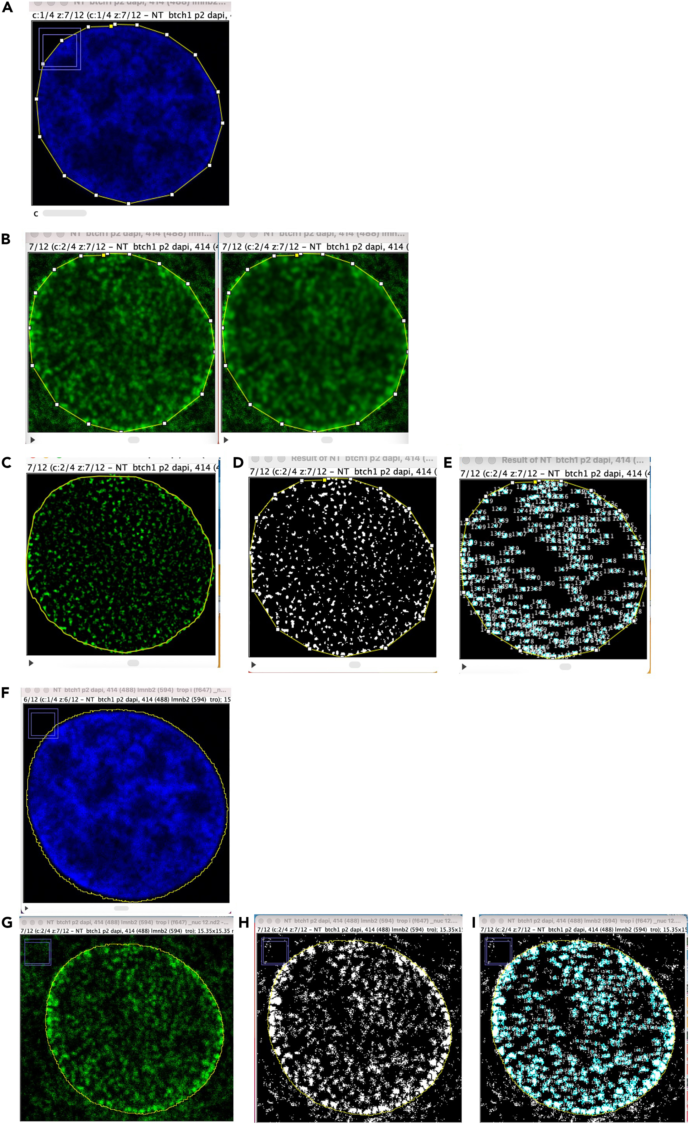 Protocol to image and quantify nuclear pore complexes using