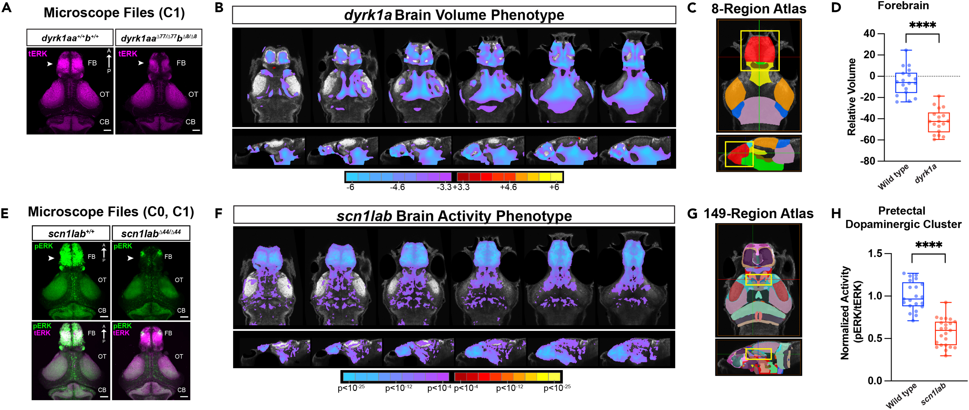 Brain Registration and Evaluation for Zebrafish (BREEZE)-mapping
