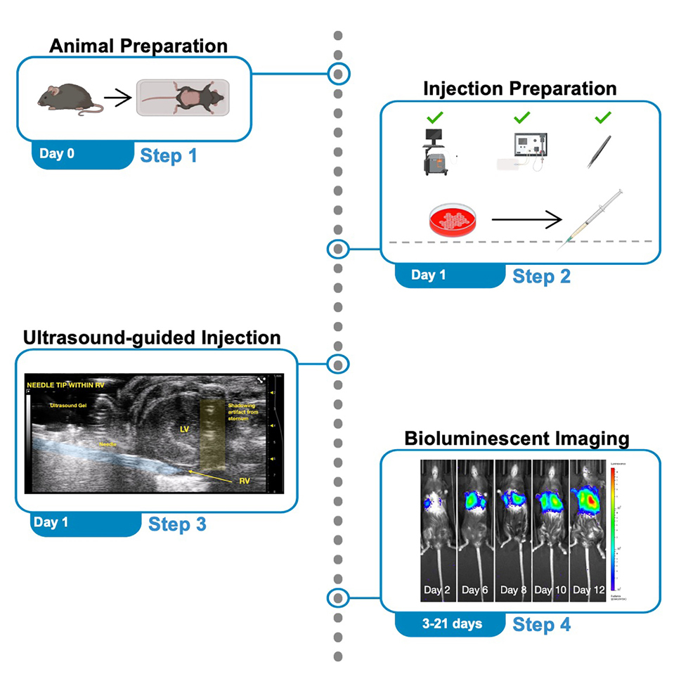 injection intraventriculaire