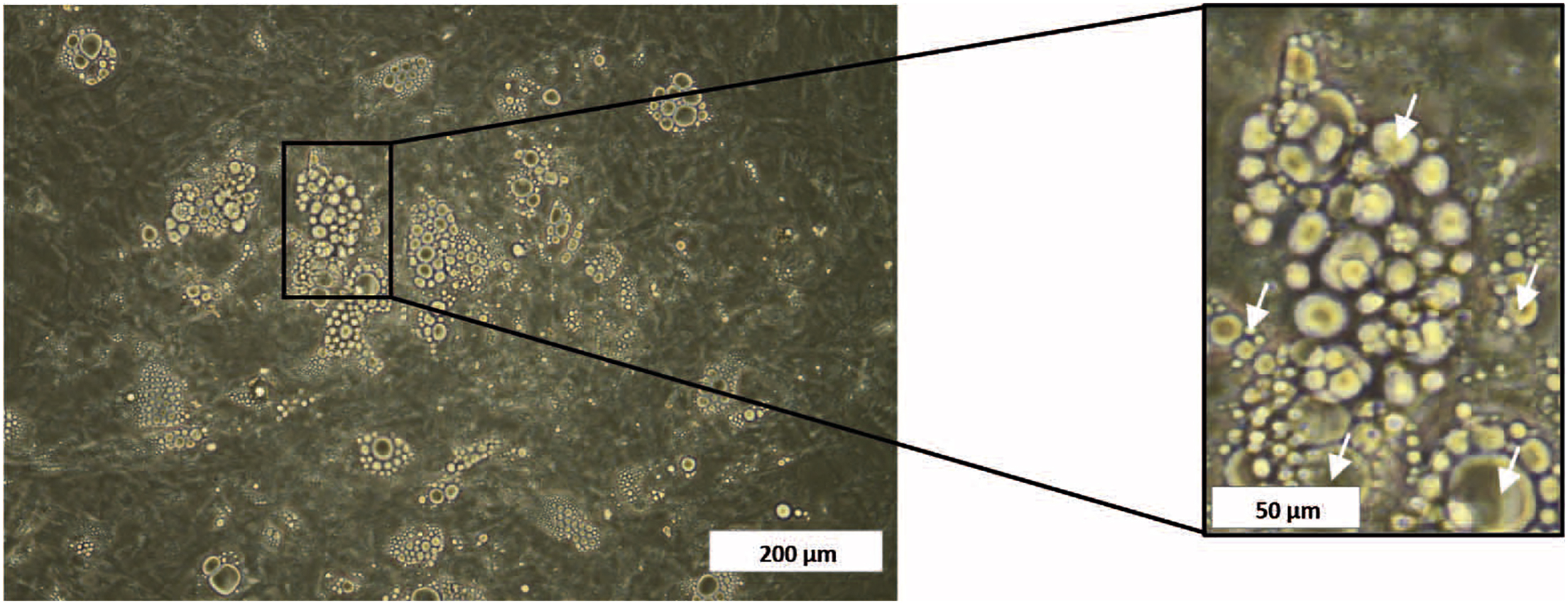 Obtaining Human Breast Adipose Cells for Breast Cancer Cell Co-culture  Studies