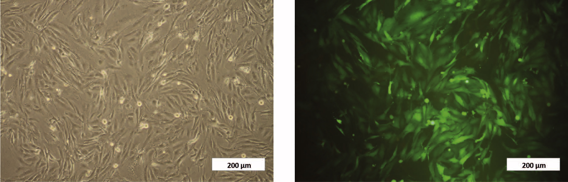 Obtaining Human Breast Adipose Cells for Breast Cancer Cell Co-culture  Studies