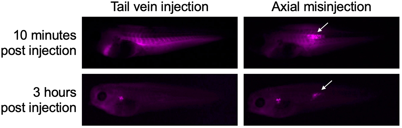 Protocol for tail vein injection in Xenopus tropicalis tadpoles