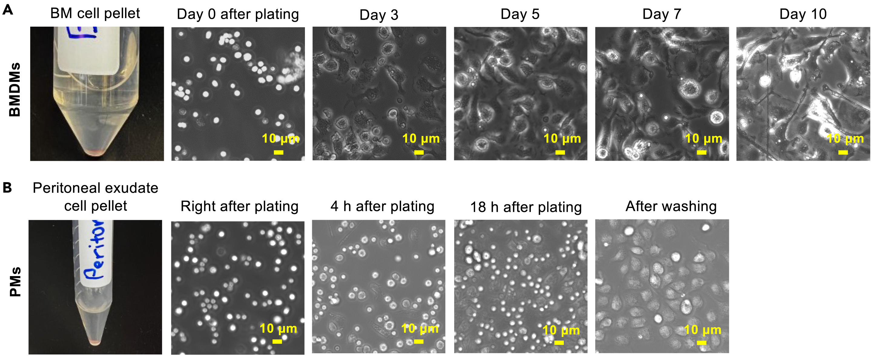 Efferocytosis assay to quantify the engulfment and