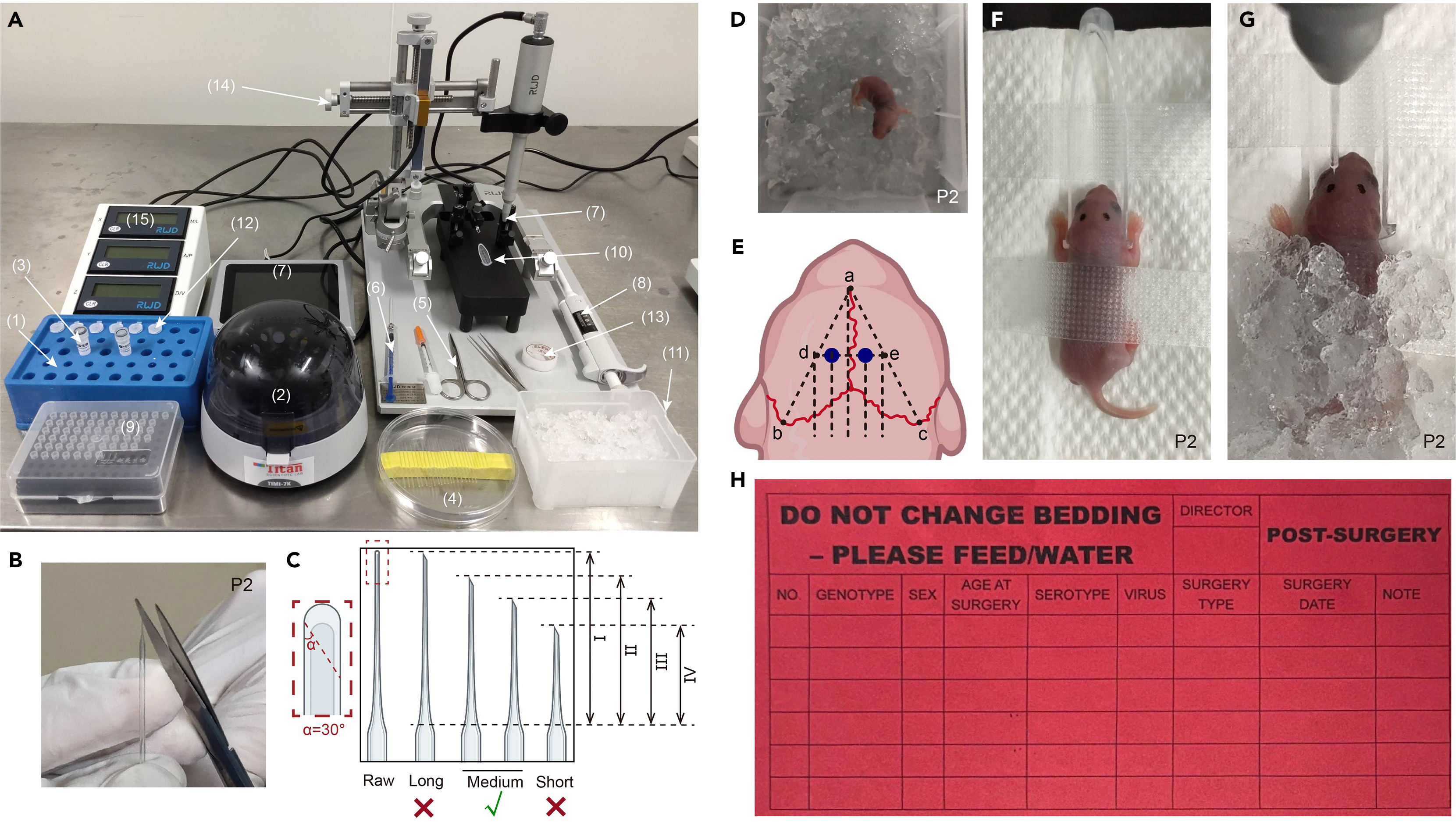 Protocol for the neonatal intracerebroventricular delivery