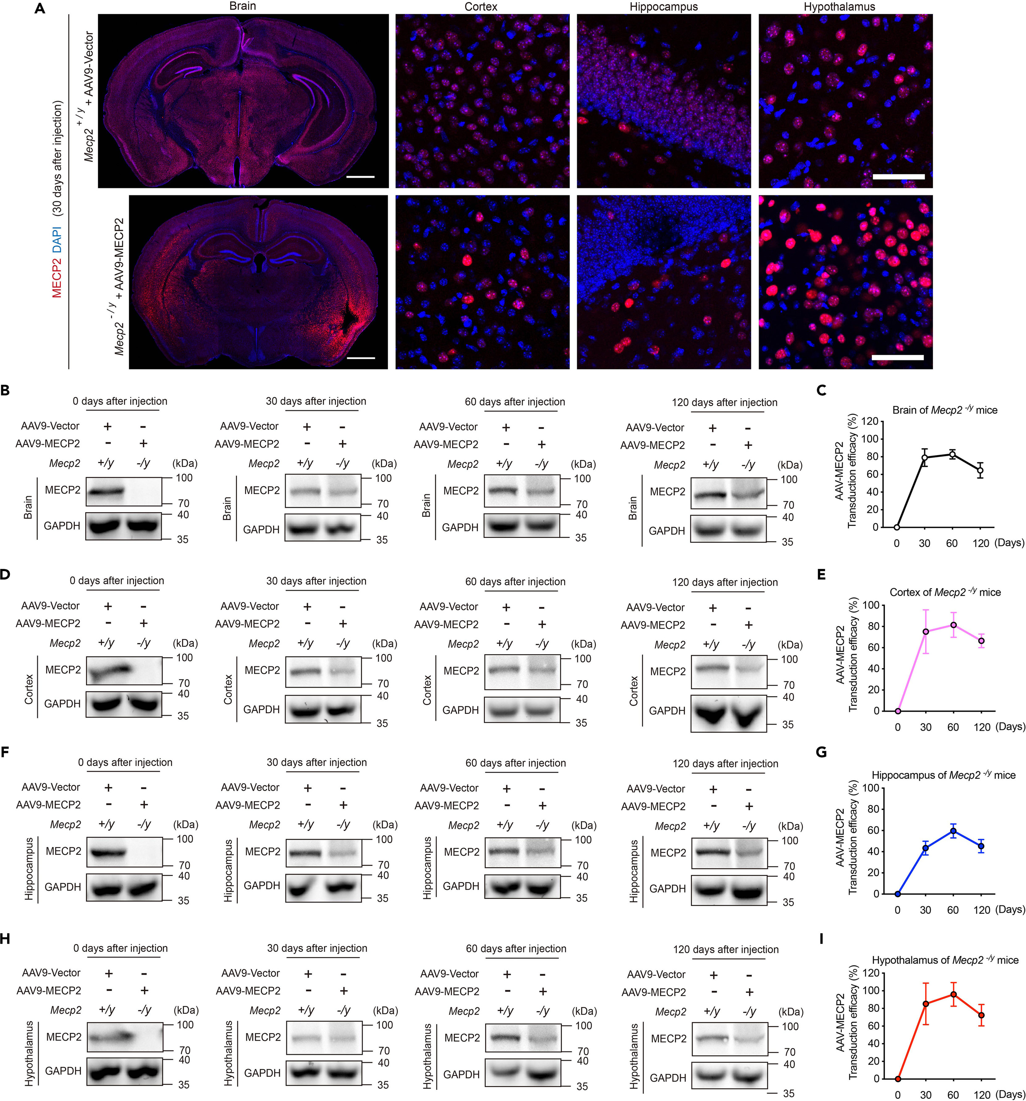 Protocol for the neonatal intracerebroventricular delivery of