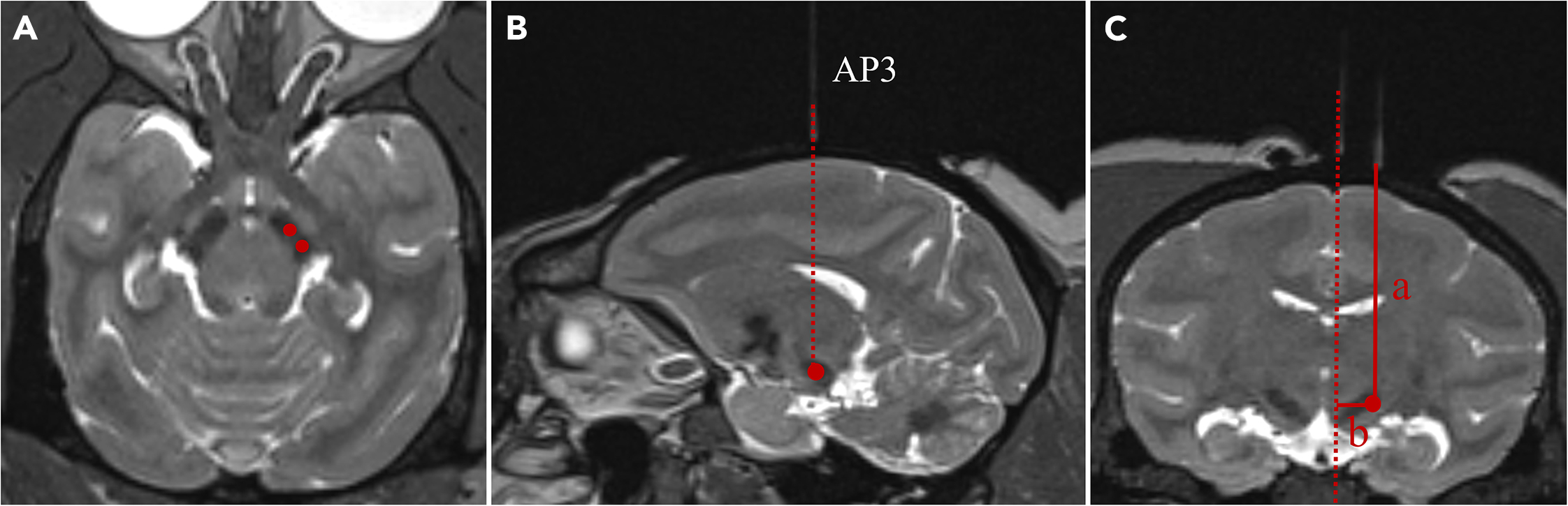 Intracerebral (ICM) Injection: Precision Targeting For CNS Therapeutics ...