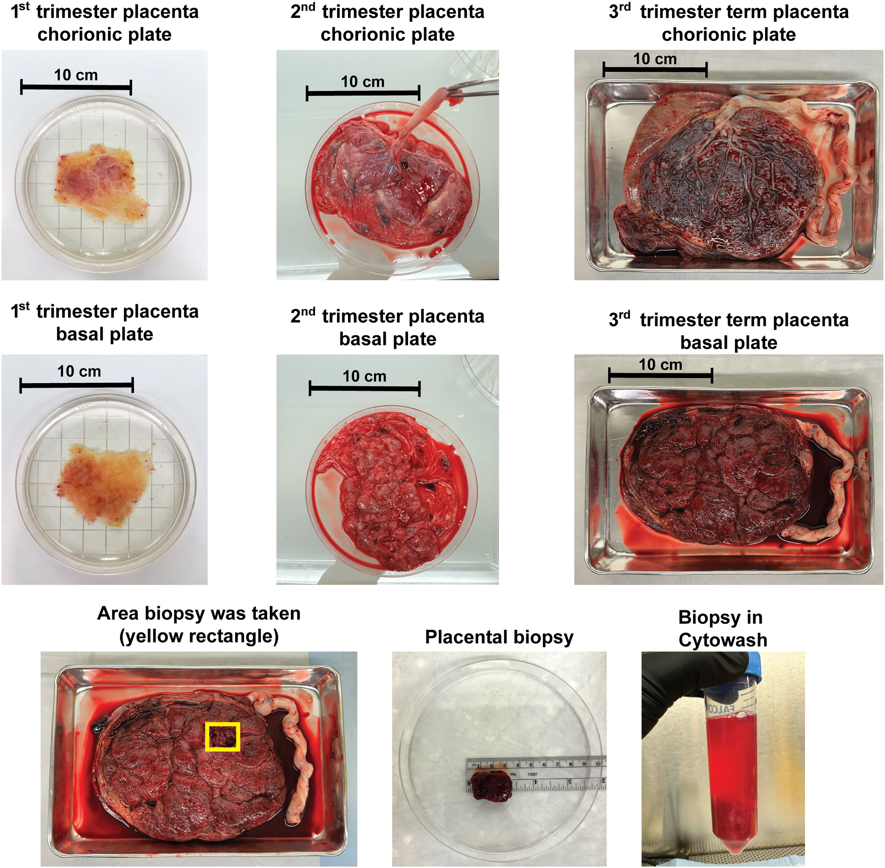 An ex vivo human placental explant model for controlled exposure