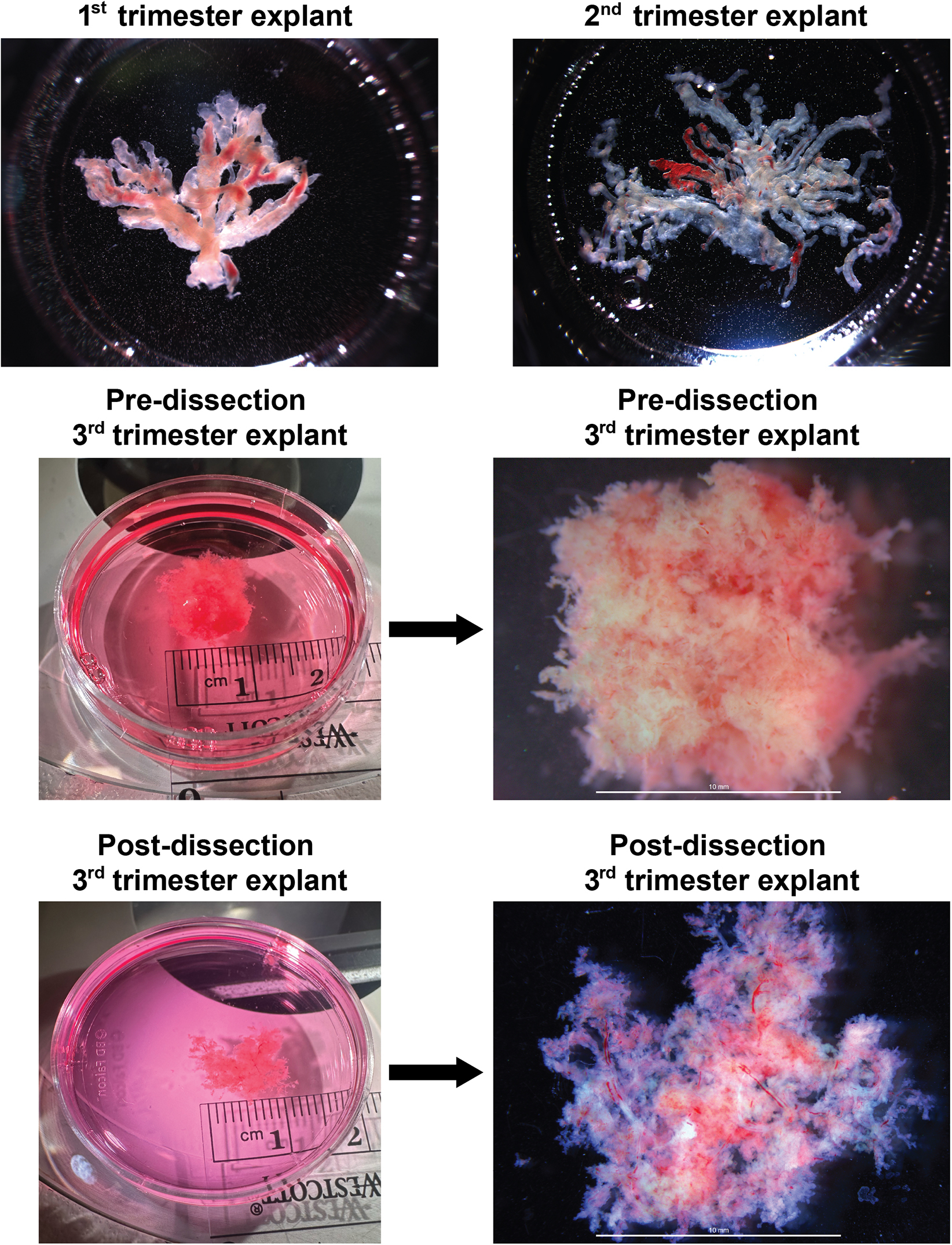 An ex vivo human placental explant model for controlled exposure