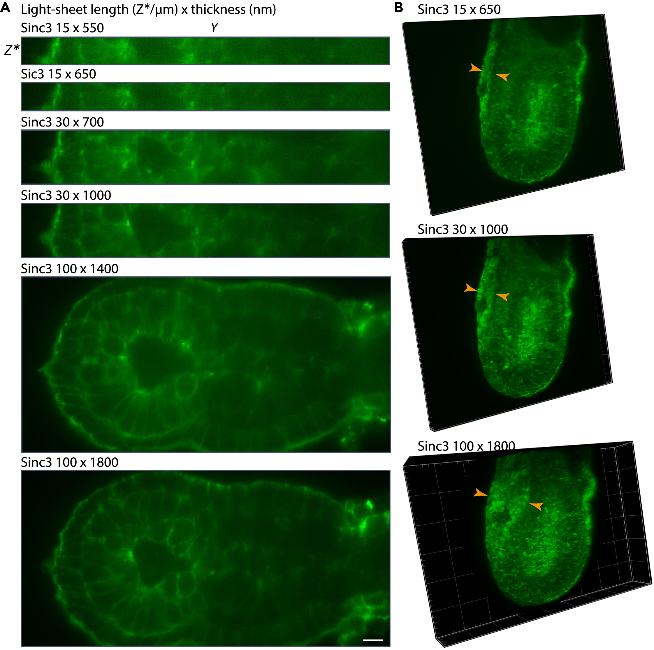ゾウ Protocol for lattice light-sheet time-lapse imaging of early post