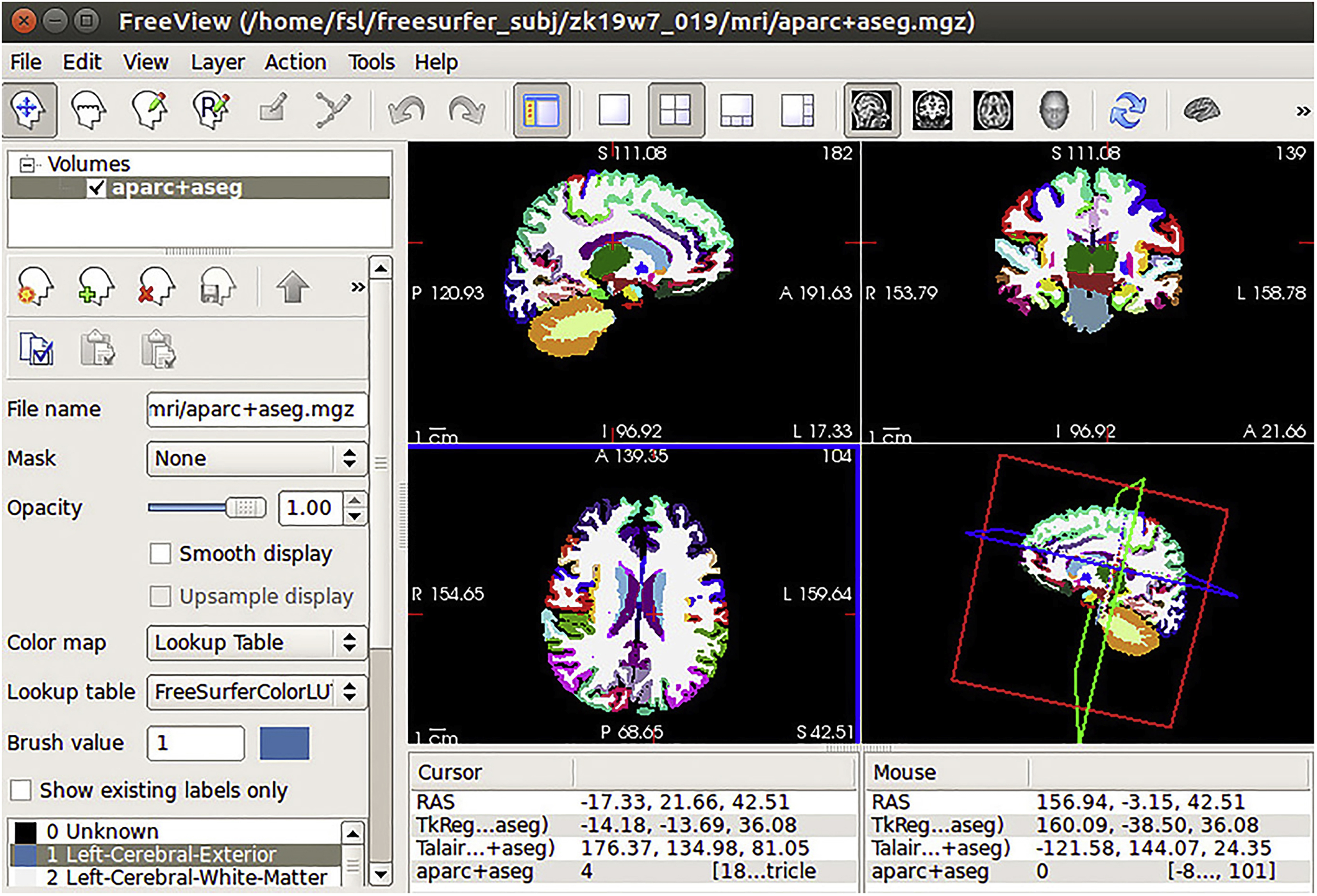 fMRI 原理と実践 fMRI | 福山秀直 |本 | 通販 | Amazon