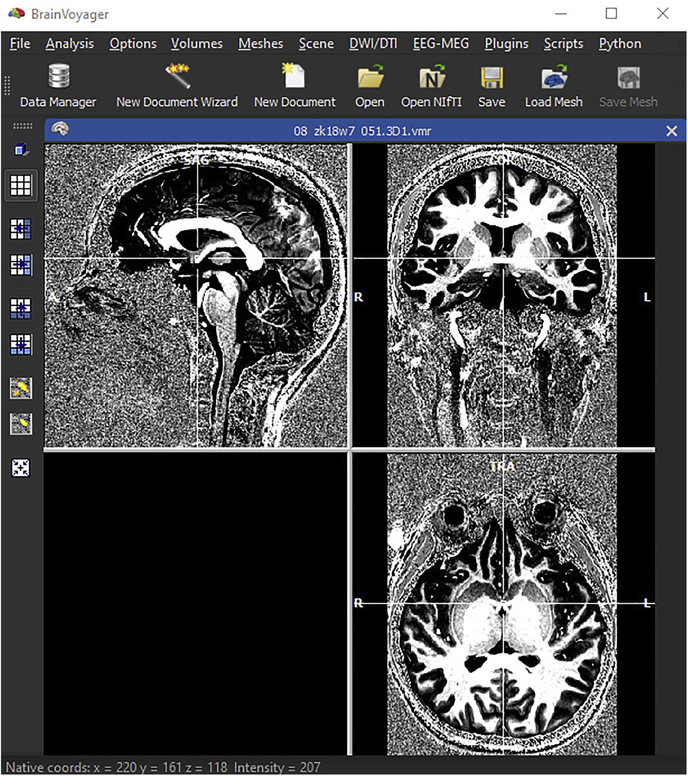 A protocol for ultra-high field laminar fMRI in the human brain