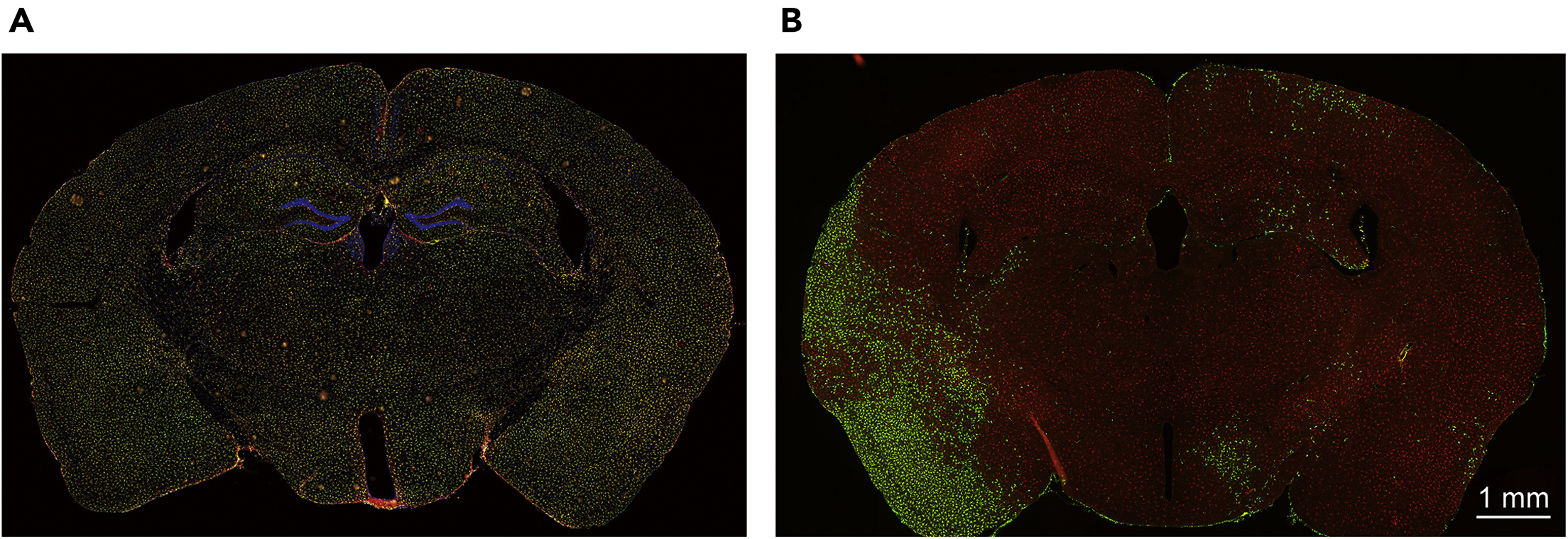 Microglia replacement by bone marrow transplantation (Mr BMT