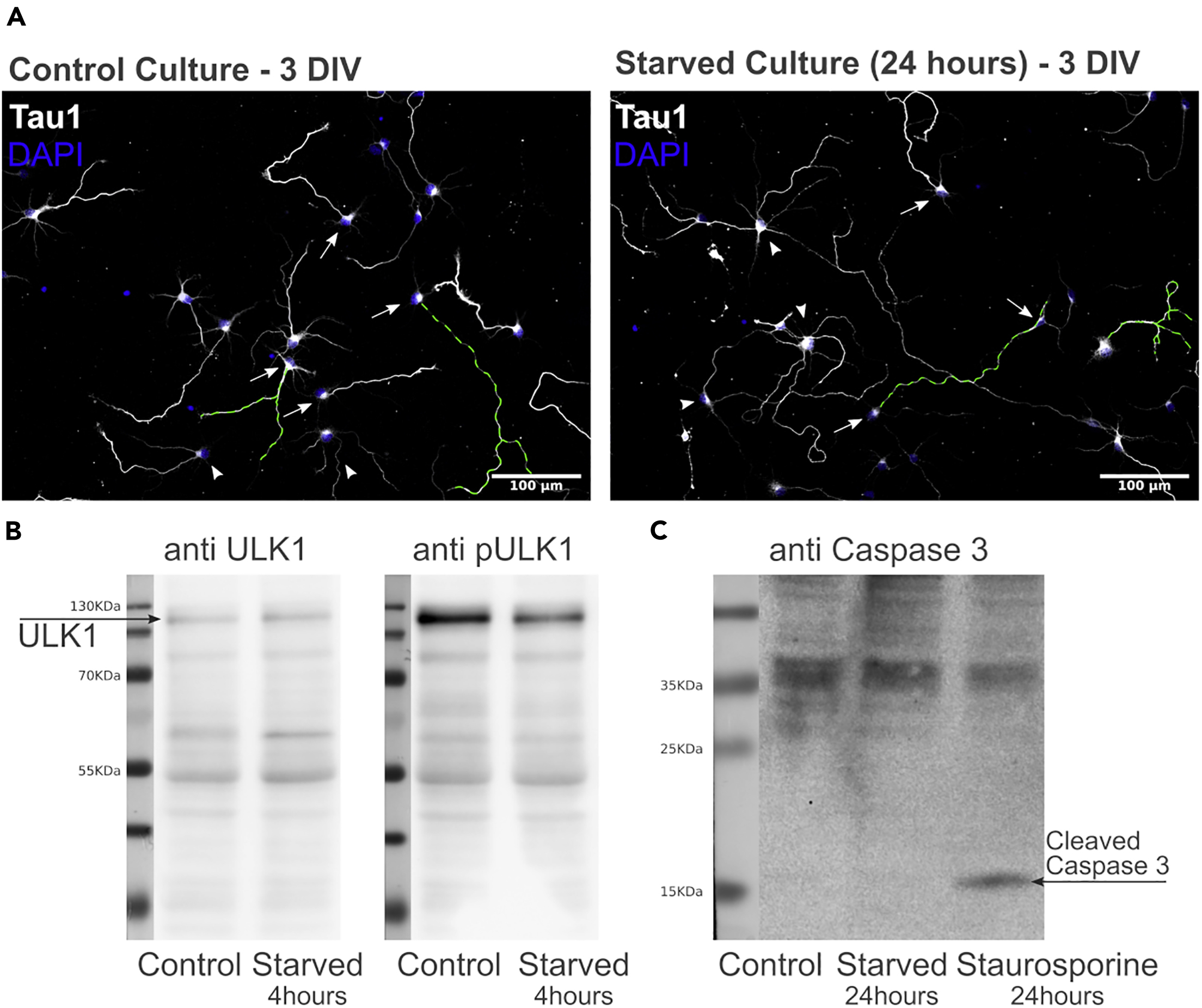 Protocol to study starvation-induced autophagy in developing rat